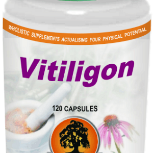 Vitiligon (120) Willow