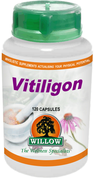 Vitiligon (120) Willow